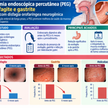 Impact of Percutaneous Endoscopic Gastrostomy on the Esophageal/ Gastric Mucosa and Helicobacter pylori in Individuals with Neurogenic Oropharyngeal Dysphagia
