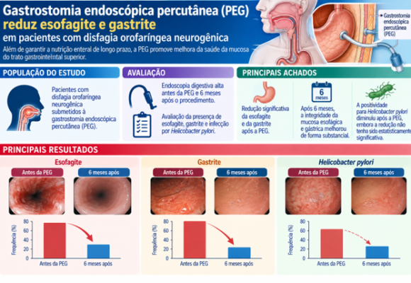 Impact of Percutaneous Endoscopic Gastrostomy on the Esophageal Impact of Percutaneous Endoscopic Gastrostomy on the Esophageal/ Gastric Mucosa and Helicobacter pylori in Individuals with Neurogenic Oropharyngeal Dysphagia